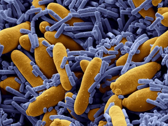 Микробы-устойчивые-к-антибиотикам-атакуют-человечество