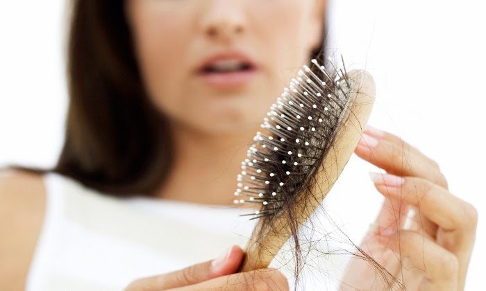 Autoimmune-related-hair-loss