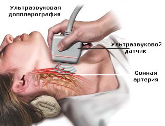Ультразвук щитовидной железы