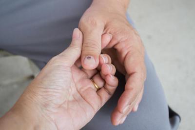 Темные пятна на ногтях - причины появления и народные методы лечения