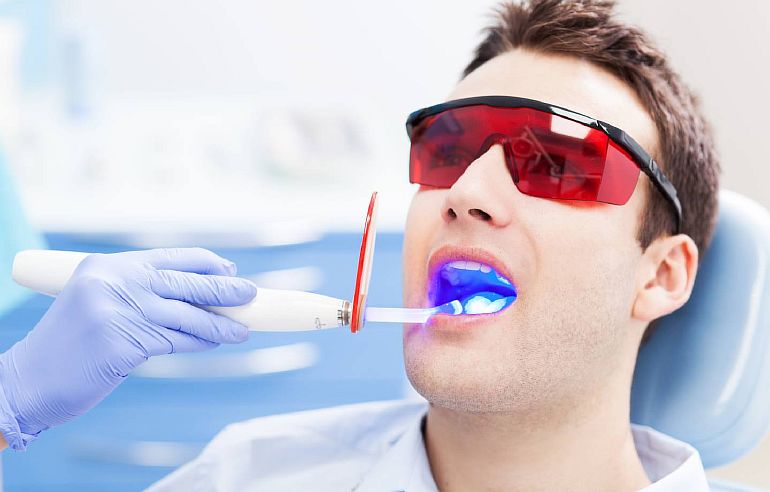 Киста зуба: симптомы и лечение